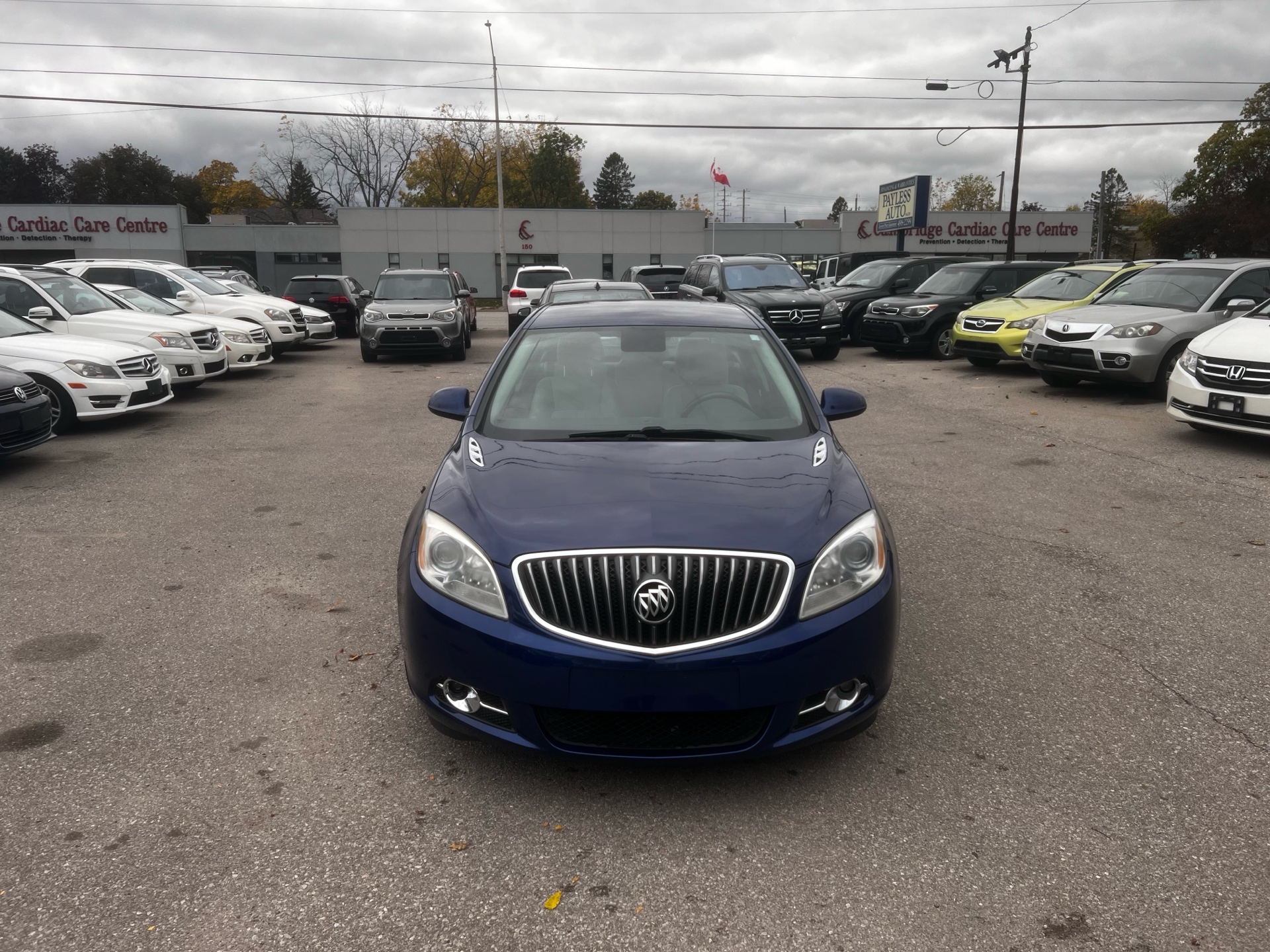 2014 Buick Verano